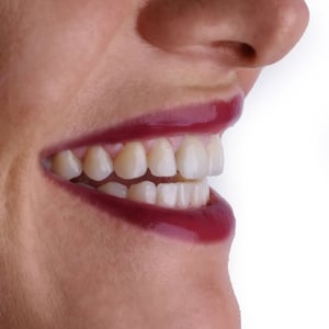 Primo piano laterale di un sorriso femminile con labbra truccate di rosso e denti bianchi visibili in profilo, che enfatizza la salute e l’estetica del sorriso