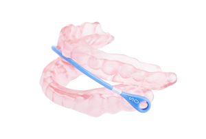 Fotografia di un apparecchio di avanzamento mandibolare (MAD) rosa con barra di connessione blu, utilizzato per trattare il russamento e le apnee notturne lievi-moderate mantenendo aperte le vie aeree durante il sonno